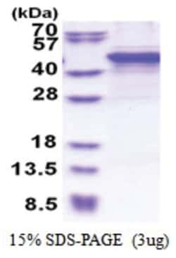 Novus Biologicals Recombinant Human MMP-10 His Protein 0.5 mg | Buy Online | Novus Biologicals&trade; | Fisher Scientific