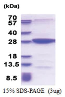 Novus Biologicals&trade;&nbsp;Recombinant Human MOBKL2B His Protein