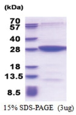Novus Biologicals Recombinant Human MOBKL2B His Protein 0.25 mg | Buy Online | Novus Biologicals&trade; | Fisher Scientific