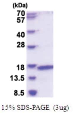 Novus Biologicals&trade;&nbsp;Recombinant Human MRPL2 His Protein