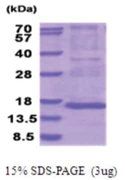 Novus Biologicals&trade;&nbsp;Recombinant Human MRPS28 His Protein