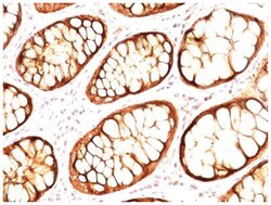 MUC1 Antibody (GP1.4 + E29), Novus Biologicals:Antibodies:Primary Antibodies