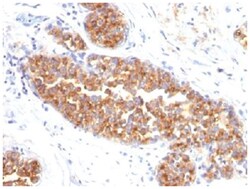MUC1 Antibody (MUC1/845) - Azide and BSA Free, Novus Biologicals:Antibodies:Primary