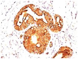 MUC1 Antibody (MUC1/845) - Azide and BSA Free, Novus Biologicals:Antibodies:Primary