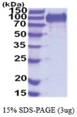 Novus Biologicals Recombinant Mouse MUCDHL His Protein 0.25 mg | Buy Online | Novus Biologicals&trade; | Fisher Scientific