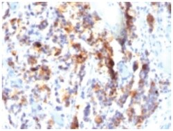 Mucin 5AC Mouse, Clone: SPM297, Novus Biologicals 0.1mg; Unlabeled:Antibodies,