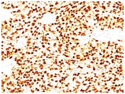 MyoD Antibody (MYD712), Novus Biologicals:Antibodies:Primary Antibodies