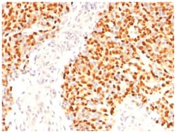 MyoD Mouse, Clone: SPM427, Novus Biologicals 0.2mg; Unlabeled:Antibodies,