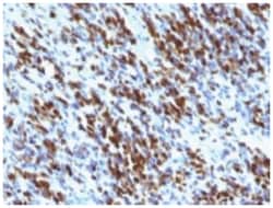 Myogenin Mouse, Clone: MGN185 + F5D, Novus Biologicals:Antibodies:Primary