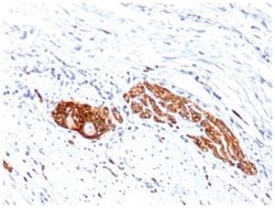 NCAM-1/CD56 Antibody (123A8 (same as 56C04)), Novus Biologicals 0.02mg;