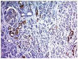 NCAM-1/CD56 Antibody (123A8 (same as 56C04)), Novus Biologicals 0.02mg;