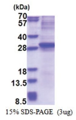 Novus Biologicals Recombinant Human Neurogenin-3 His Protein 0.02 mg | Buy Online | Novus Biologicals&trade; | Fisher Scientific
