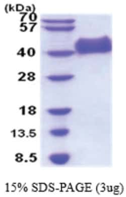 Novus Biologicals&trade;&nbsp;Recombinant Human NGFR/TNFRSF16/p75NTR His Protein