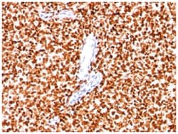 NKX2.2 Mouse, Clone: SPM564, Novus Biologicals 0.02mg; Unlabeled:Antibodies,