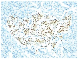 NKX2.2 Mouse, Clone: SPM564, Novus Biologicals 0.02mg; Unlabeled:Antibodies,
