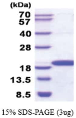 Novus Biologicals&trade;&nbsp;Recombinant Human NME3 His Protein