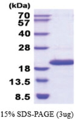 Novus Biologicals Recombinant Human NME4 His Protein 0.05 mg | Buy Online | Novus Biologicals&trade; | Fisher Scientific