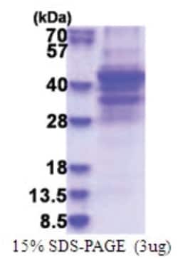 Novus Biologicals Recombinant Human NSP 5 alpha 3 alpha His Protein 0.05 mg | Buy Online | Novus Biologicals&trade; | Fisher Scientific