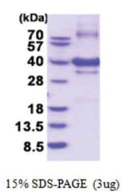 Novus Biologicals&trade;&nbsp;Recombinant Human NUBP1 His Protein