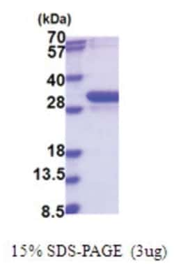 Novus Biologicals&trade;&nbsp;Recombinant Human NUBP2 His Protein