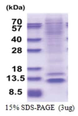 Novus Biologicals&trade;&nbsp;Recombinant Human NUP62CL His Protein