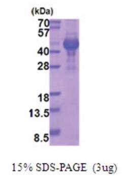 Novus Biologicals Recombinant Human Opticin His Protein 0.1 mg | Buy Online | Novus Biologicals&trade; | Fisher Scientific