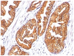 Ornithine Decarboxylase Mouse, Clone: SPM565, Novus Biologicals 0.02mg;