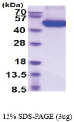 Novus Biologicals&trade;&nbsp;Recombinant Mouse Osteoprotegerin/TNFRSF11B His Protein