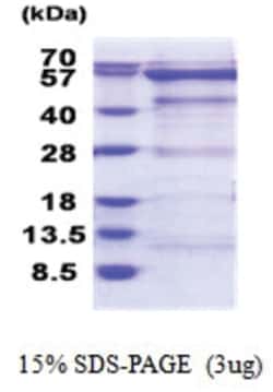 Novus Biologicals&trade;&nbsp;Recombinant Human OXSR1 His Protein
