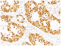 p53 Mouse, Clone: BP53-12 + DO-7, Novus Biologicals 0.2mg; Unlabeled:Antibodies,