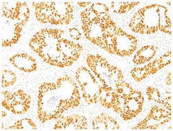 p53 Mouse, Clone: SPM590, Novus Biologicals:Antibodies:Primary Antibodies