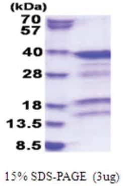 Novus Biologicals&trade;&nbsp;Recombinant Human PACT His Protein