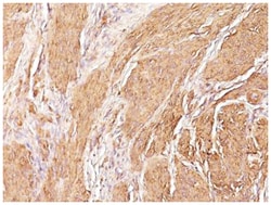 pan Actin Mouse, Clone: HHF35, Novus Biologicals 0.1mg; Unlabeled:Antibodies,