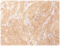 pan Actin Mouse, Clone: HHF35, Novus Biologicals 0.1mg; Unlabeled:Antibodies,