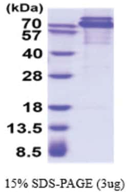 Novus Biologicals&trade;&nbsp;Recombinant Human pan Cadherin His Protein