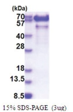 Novus Biologicals&trade;&nbsp;Recombinant Human Paralemmin His Protein