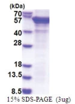 Novus Biologicals Recombinant Human PCID2 His Protein 0.1 mg | Buy Online | Novus Biologicals™ | Fisher Scientific