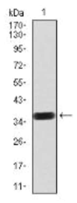 PDGF R beta Antibody (2G7B7) - BSA Free, Novus Biologicals 0.1 mg | Buy Online | Novus Biologicals | Fisher Scientific