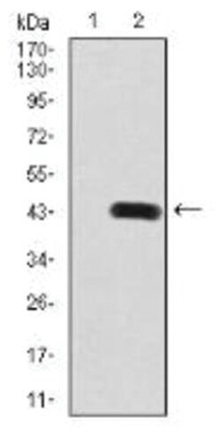 PDGF R beta Antibody (2G7B7) - BSA Free, Novus Biologicals 0.1 mg | Buy Online | Novus Biologicals | Fisher Scientific