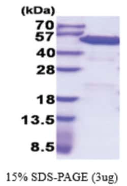 Novus Biologicals&trade;&nbsp;Recombinant Human PDIA6 His Protein