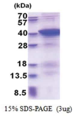 Novus Biologicals Recombinant Human PDLIM1 His Protein 0.1 mg | Buy Online | Novus Biologicals&trade; | Fisher Scientific