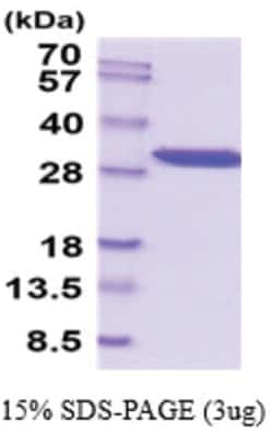 Novus Biologicals&trade;&nbsp;Recombinant Human PGAM1 His Protein