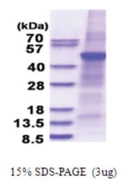 Novus Biologicals Recombinant Human PLA1A His Protein 0.5 mg | Buy Online | Novus Biologicals&trade; | Fisher Scientific