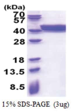 Novus Biologicals&trade;&nbsp;Recombinant Human PLEKHF2 His Protein