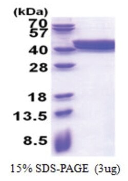 Novus Biologicals Recombinant Human PLEKHF2 His Protein 0.1 mg | Buy Online | Novus Biologicals&trade; | Fisher Scientific