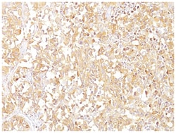 PMEL17/SILV Mouse, Clone: SPM142, Novus Biologicals 0.02mg; Unlabeled:Antibodies,