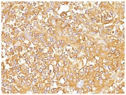 PMEL17/SILV Mouse, Clone: SPM142, Novus Biologicals 0.02mg; Unlabeled:Antibodies,