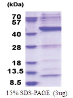 Novus Biologicals&trade;&nbsp;Recombinant Human POLR1C His Protein