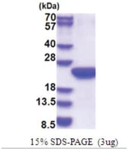 Novus Biologicals&trade;&nbsp;Recombinant Human POLR2F His Protein