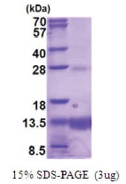 Novus Biologicals&trade;&nbsp;Recombinant Human POLR2K His Protein
